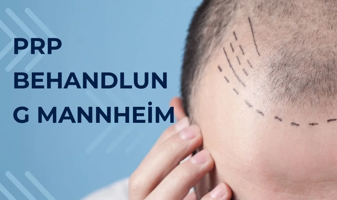 PRP Behandlung Mannheim